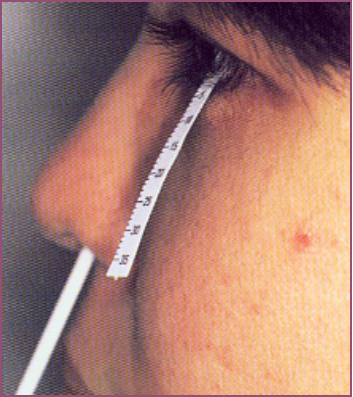 眼表眼角膜,希瑪瑞視眼科,上海眼科醫院 眼表眼角膜,希瑪瑞視眼科,上海眼科醫院