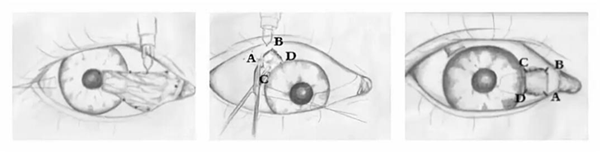 眼表眼角膜,希瑪瑞視眼科,上海眼科醫院 眼表眼角膜,希瑪瑞視眼科,上海眼科醫院