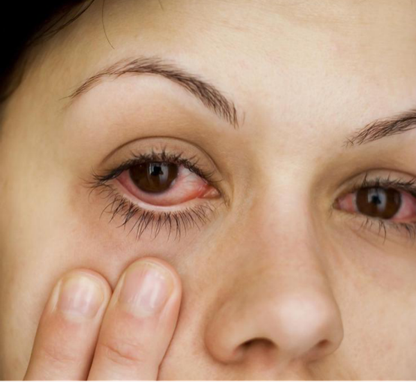 眼表眼角膜,希瑪瑞視眼科,上海眼科醫院 眼表眼角膜,希瑪瑞視眼科,上海眼科醫院