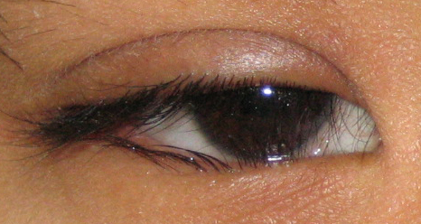 眼眶病,希瑪瑞視眼科,上海眼科醫院 眼眶病,希瑪瑞視眼科,上海眼科醫院