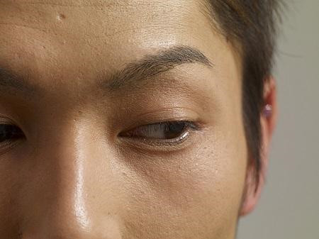 小兒眼病,希瑪瑞視眼科,上海眼科醫(yī)院 小兒眼病,希瑪瑞視眼科,上海眼科醫(yī)院