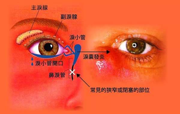 眼眶病,希瑪瑞視眼科,上海眼科醫(yī)院 眼眶病,希瑪瑞視眼科,上海眼科醫(yī)院