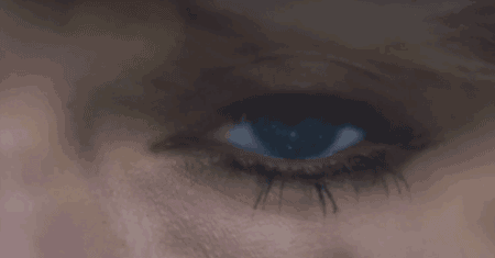 青光眼,希瑪瑞視眼科,上海眼科醫院