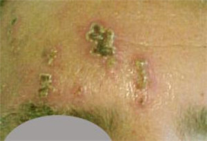 眼表眼角膜,希瑪瑞視眼科,上海眼科醫(yī)院 眼表眼角膜,希瑪瑞視眼科,上海眼科醫(yī)院