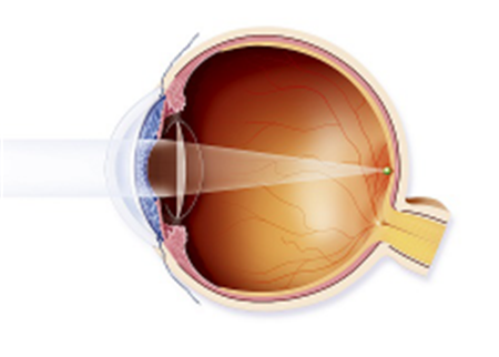 玻璃體視網(wǎng)膜,希瑪瑞視眼科,上海眼科醫(yī)院