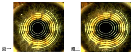 小兒眼病,?，斎鹨曆劭?上海眼科醫院