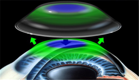 小兒眼病,希瑪瑞視眼科,上海眼科醫(yī)院 小兒眼病,希瑪瑞視眼科,上海眼科醫(yī)院