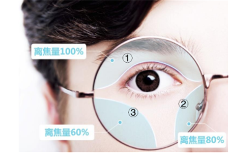 小兒眼病,希瑪瑞視眼科,上海眼科醫院