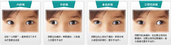 小兒眼病,希瑪瑞視眼科,上海眼科醫(yī)院 小兒眼病,希瑪瑞視眼科,上海眼科醫(yī)院