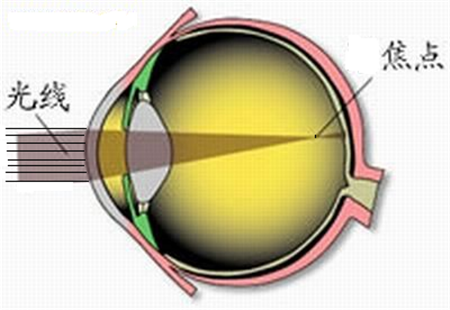 屈光矯視,希瑪瑞視眼科,上海眼科醫院 屈光矯視,希瑪瑞視眼科,上海眼科醫院