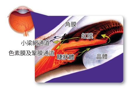 青光眼,希瑪瑞視眼科,上海眼科醫院