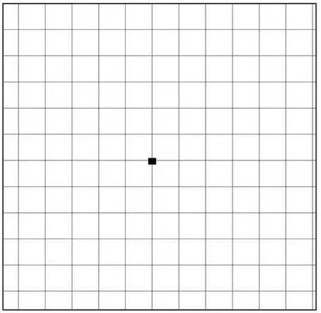 玻璃體視網膜,希瑪瑞視眼科,上海眼科醫院
