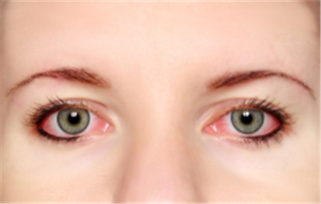 眼表眼角膜,希瑪瑞視眼科,上海眼科醫院 眼表眼角膜,希瑪瑞視眼科,上海眼科醫院