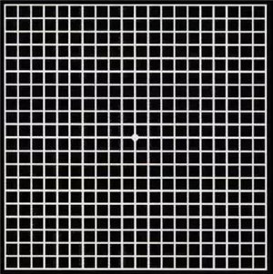 玻璃體視網(wǎng)膜,希瑪瑞視眼科,上海眼科醫(yī)院 玻璃體視網(wǎng)膜,希瑪瑞視眼科,上海眼科醫(yī)院