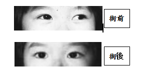 小兒眼病,希瑪瑞視眼科,上海眼科醫(yī)院 小兒眼病,希瑪瑞視眼科,上海眼科醫(yī)院