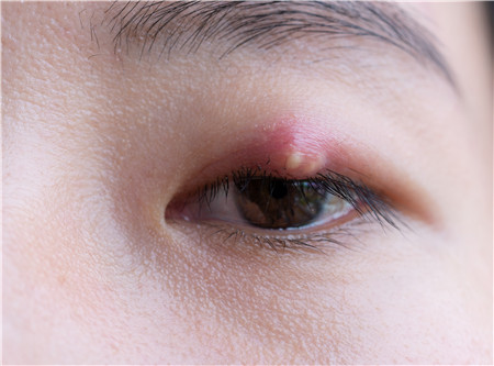 眼眶病,希瑪瑞視眼科,上海眼科醫(yī)院 眼眶病,希瑪瑞視眼科,上海眼科醫(yī)院