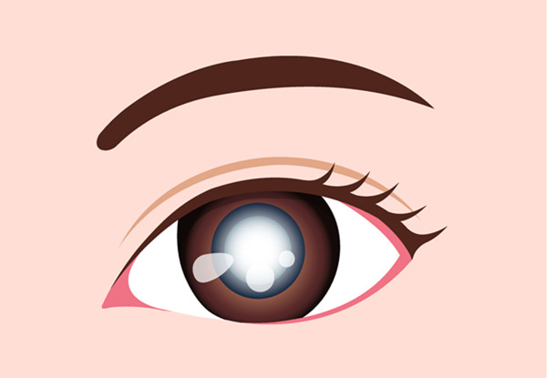 小兒眼病,希瑪瑞視眼科,上海眼科醫院 小兒眼病,希瑪瑞視眼科,上海眼科醫院